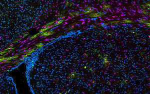 Wissenschaftler wagen den Blick ins Gehirn einer Maus (Foto: monash.edu)