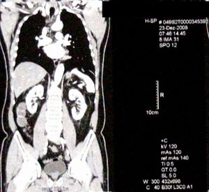 Röntgen: bessere Chancen bei Transplantation (Foto: pixelio.de, Hartmut910)