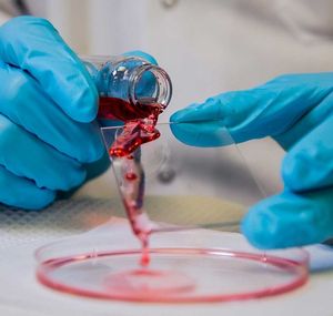 Im Test: Zähe Flüssigkeit tropft ab (Foto: Robert Coelius, Michigan Engineering)