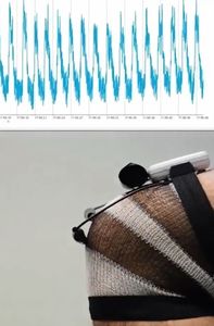 Material am Knie: Einsatz an Gelenken besonders sinnvoll (Foto: deakin.edu.au)