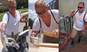 Versuche: Prothesenträger testen das neue Modul ausgiebig (Foto: illinois.edu)