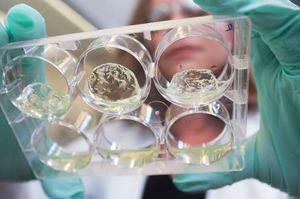 Neue Hydrogele, die Langerhans-Inseln enthalten (Foto: C. Moore, gatech.edu)