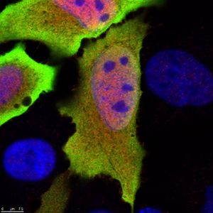 C6: Neues Gen identifiziert (Foto: csiro.au) C6: Neues Gen identifiziert (Foto: csiro.au)