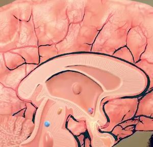 PET-Aufnahme: Forscher wollen Alzheimer noch früher erkennen (Foto: yale.edu)