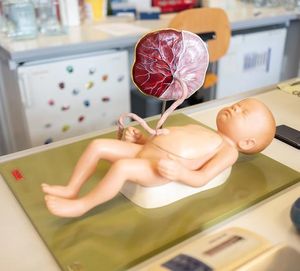 Plazenta-Probleme beeinflussen Fötus-Versorgung (Foto: rub.de, Kramer)