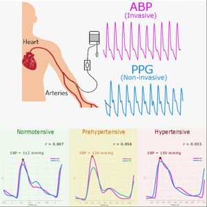 Blutdruckmessung: Pulsoximeter als Alternative (Foto: Mohamed Elgendi, ubc.ca)