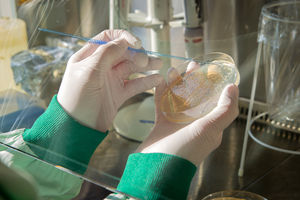 Auftragen von Probe auf Agarplatte (Foto: InfectoGnostics, Fotostudio Ebenbild)