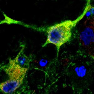 Nervenzellen: Mausmodell gegen Schlaganfälle (Foto: Steven Graham, pitt.edu)