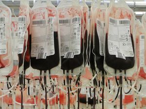 Blutbeutel: Es besteht immer Bedarf an Spenden (Foto: pixabay.com, sabinurce)