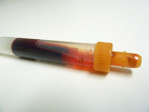 Blutprobe: neue Diagnosemöglichkeiten in Sicht (Foto: pixelio.de, Andrea Damm)