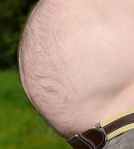 Übergewicht: SRC-1-Gen beeinflusst Appetit (Foto: pixabay.com, Pezibear)
