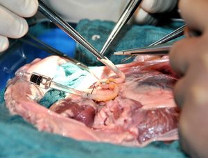 OP: Tumorzellen leuchten jetzt hell auf (Foto: HansMartinPaul, pixabay.com) OP: Tumorzellen leuchten jetzt hell auf (Foto: HansMartinPaul, pixabay.com)