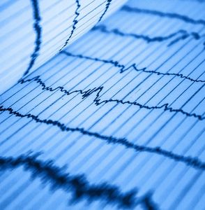 EKG: bald künstlicher Herzmuskel möglich (Foto: pixabay.com, rezendeluan)