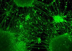 Mini-Gehirne: im Labor gezüchtet (Foto: kyoto-u.ac.jp/en)