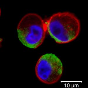 Absterbende Zellen (rot); grün, wo FHR1 bereits andocken konnte (Bild: Skerka)