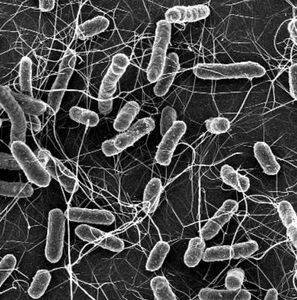 Salmonellen: Bakterien verursachen Infektionen (Foto: ethz.ch, Stefan Fattinger)