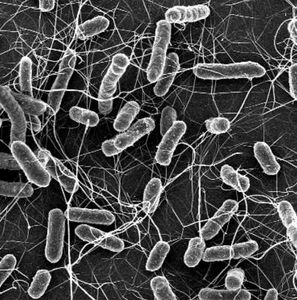 Salmonellen: Bakterien verursachen Infektionen (Foto: ethz.ch, Stefan Fattinger)