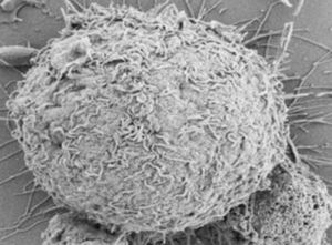 Nützliche MAIT-Zellen unter dem Mikroskop (Foto: oxfordbrc.nihr.ac.uk)