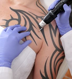 Beim Tattoo-Stechen: mag nicht jeder Arbeitgeber (Foto: pixabay.com, 2298149)