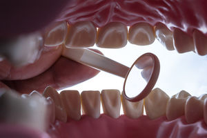 Gebiss: Zahnverlust sollte man ernst nehmen (Foto: pixelio.de, Bernd Kasper)