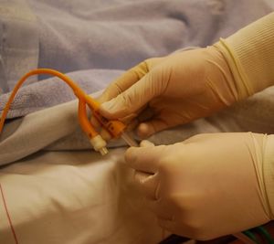 Harnkatheter: Neue Methode verhindert Infektionen (Foto: pixabay.com, eliola)