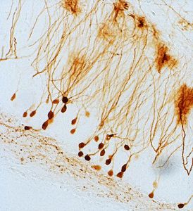 Nervenzellen im Hippokampus des Gehirns (Tiermodell) (Foto: i-med.ac.at)
