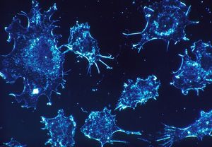 Zelldiagnose: Implantat zieht Krebszellen an (Foto: pixabay.com, skeeze)