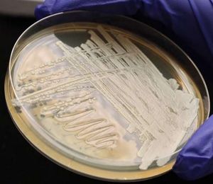 Hefezellen in einer Petrischale im Labor (Foto: Frank Wojciechowski)