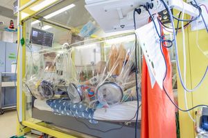 Kind mit Akuter Lymphoblastischer Leukämie (Foto: Gabriela Acklin, kispi.uzh.ch)