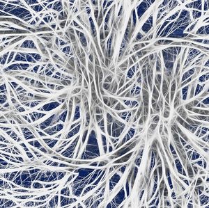 Nervenzellen: Signalprotein an MS-Entstehung beteiligt (Foto: pixabay.de/geralt)