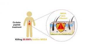 So wird eine MRSA-Infektion der Haut behandelt (Grafik: smart.mit.edu)