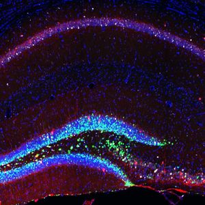 Neurale und reife Stammzellen sowie künstlich erzeugte Neuronen (crt-dresden.de)