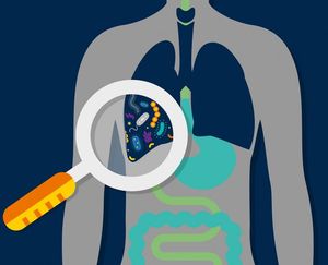 Lungenbakterien: Auswirkungen auf kritisch Kranke (Foto: Michigan Medicine)