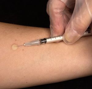 HPV-Impfung schützt gegen Gebärmutterhalskrebs (Foto: pixabay.com, WikiImages)