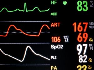 Vitalwerte: Herzinfarkte in den USA ungleich verteilt (Foto: pixelio.de, hamma)