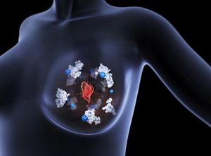 Brustkrebs: Protein Atox1 fördert Bildung von Metastasen (Foto: Boid)