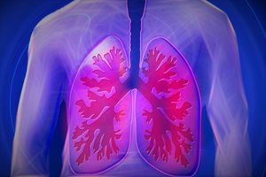 Lunge im Zentrum: COPD-Risikofaktor für Lungenkrebs (Foto: pixabay.com, kalhh)
