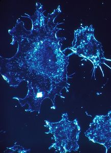 Krebszellen: Immunsystem kann noch besser kämpfen (Foto: pixabay.com, 272447)