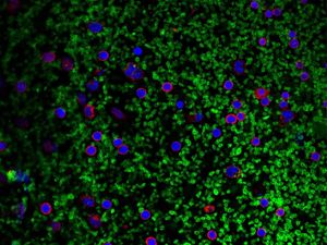 Blutplättchen (grün) aktivieren Inflammasome (rot) (Foto: uni-bonn.de)