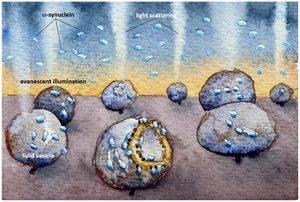 Veszikel: Schädigung durch Alpha-Synuclein (Foto: Fredrik Höök)