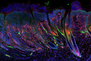 Regenerierte Haut: Gewebe ohne Narben und mit Haaren (Foto: wsu.edu)