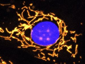 Zelle mit gesunden Mitochondrien (Foto: Jane Farrar/Daniel Maloney, tcd.ie)
