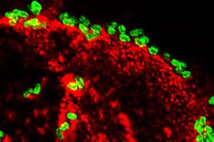 E. coli: aggressives Bakterium an der Darmwand (Foto: Alaullah Sheikh)