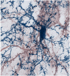 Kontakte von Mikrogliazelle mit Nervenzelle (Foto: Misgeld, Kerschensteiner)