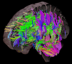 Gehirn: Scans zeigen die Verletzlichkeit des Denkorgans (Foto: sheffield.ac.uk)