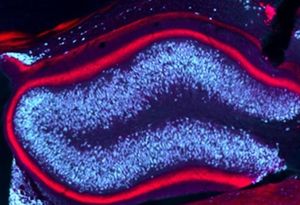 Hippocampus-Stimulation beendet Epilepsie-Anfälle (Foto: uniklinik-freiburg.de) Hippocampus-Stimulation beendet Epilepsie-Anfälle (Foto: uniklinik-freiburg.de)