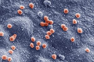 COVID-19-Viren auf der Oberfläche einer Lungenzelle (Foto: Sandor Nietzsche/UKJ)