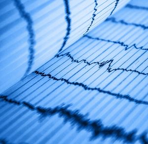 EKG: Ernährung ohne Rumensäure hält Herz gesund (Foto: pixabay.com, rezendeluan)