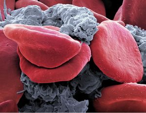 Sport führt zur verringerten Zerstörung roter Blutkörperchen (Foto: unibas.ch)