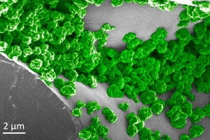 Leuchtende Nanopartikel in extremer Vergrößerung (Foto: mit.edu) Leuchtende Nanopartikel in extremer Vergrößerung (Foto: mit.edu)